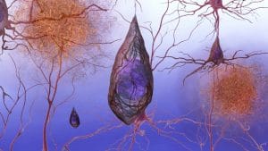 Alzheimer disease hereditary