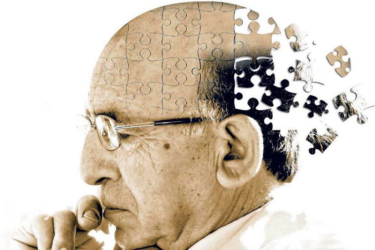 FAQ Alzheimer Disease FAQ Alzheimer's disease