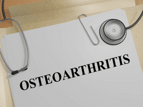 What Is Osteoarthritis? What Is Osteoarthritis?
