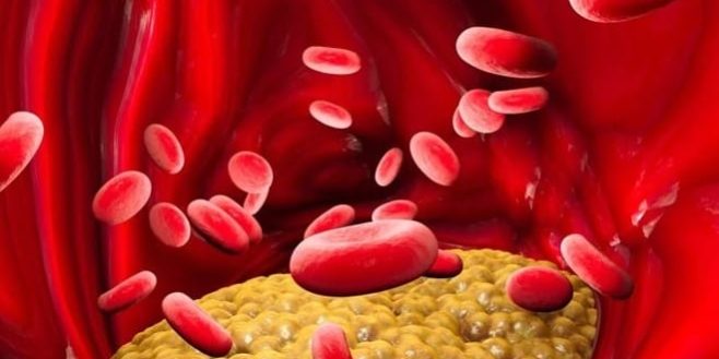 lipoprotein cholesterol, ascvd